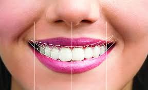Smile makeover planning